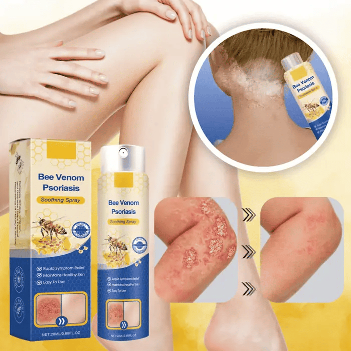 DermaEase™ Vaarwel Tegen Eczeem
