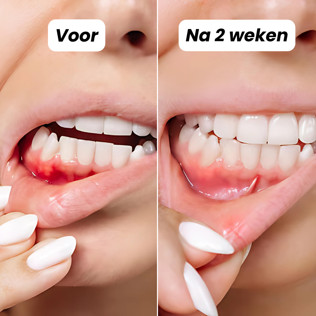 Tandheld™ | Grondige Reiniging, Frisse Adem & Gezond Tandvlees