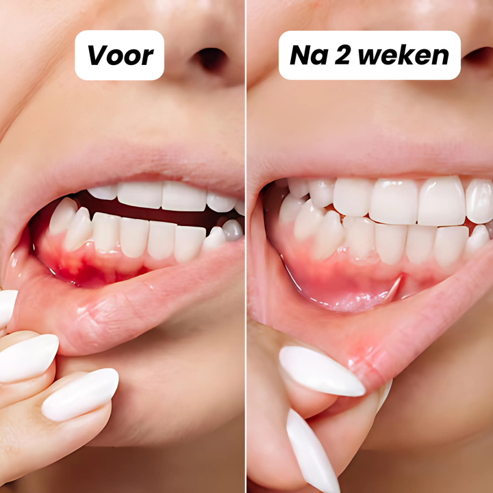 Tandheld™ | Grondige Reiniging, Frisse Adem & Gezond Tandvlees