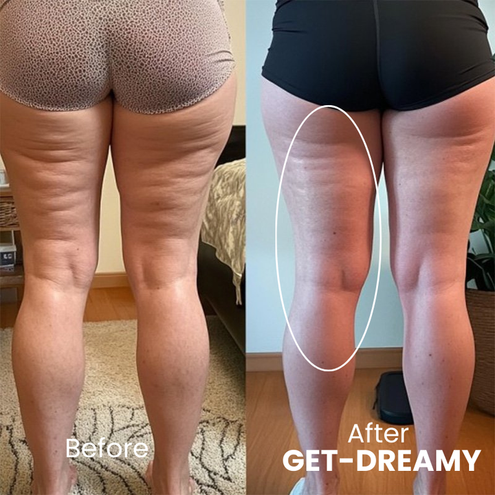 Get Dreamy™ Een Zelfverzekerde Look