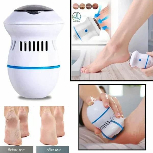 ReviveFoot Pro™ | Elektronische Eelt Verwijderaar Voeten