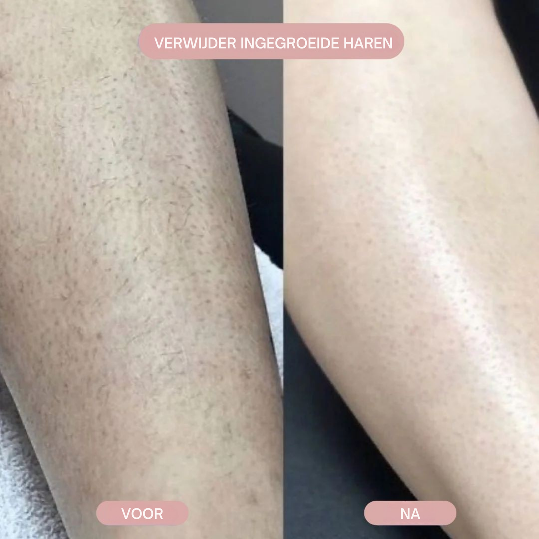 ShaveGlow™| 2-in-1 Dames Bodyshaver