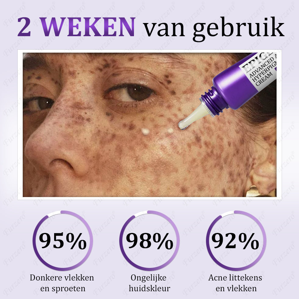 Glowvera™ Geavanceerde Anti- Hyperpigmentatie crème