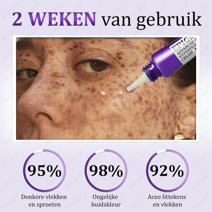 Glowvera™ Geavanceerde Anti- Hyperpigmentatie crème