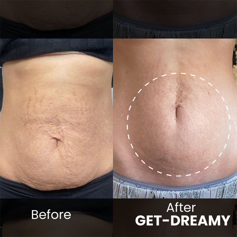 Get Dreamy™ Een Zelfverzekerde Look