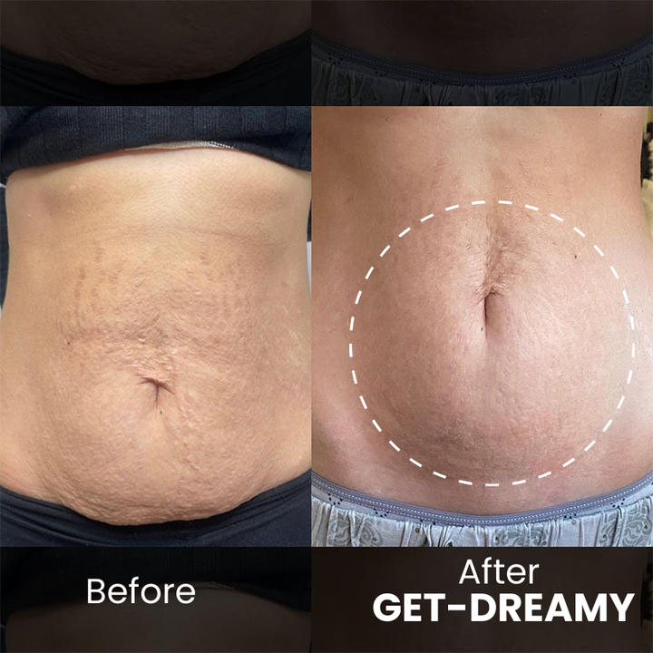 Get Dreamy™ Een Zelfverzekerde Look