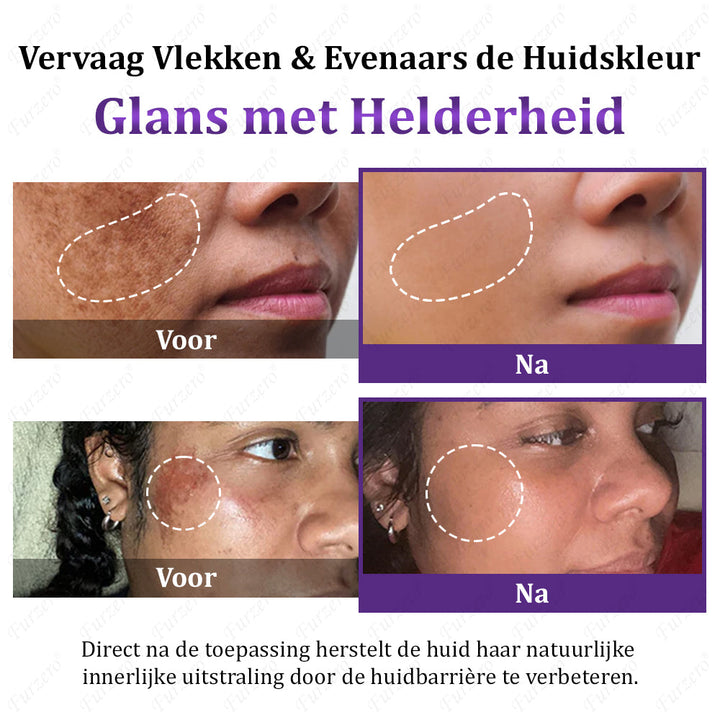Glowvera™ Geavanceerde Anti- Hyperpigmentatie crème