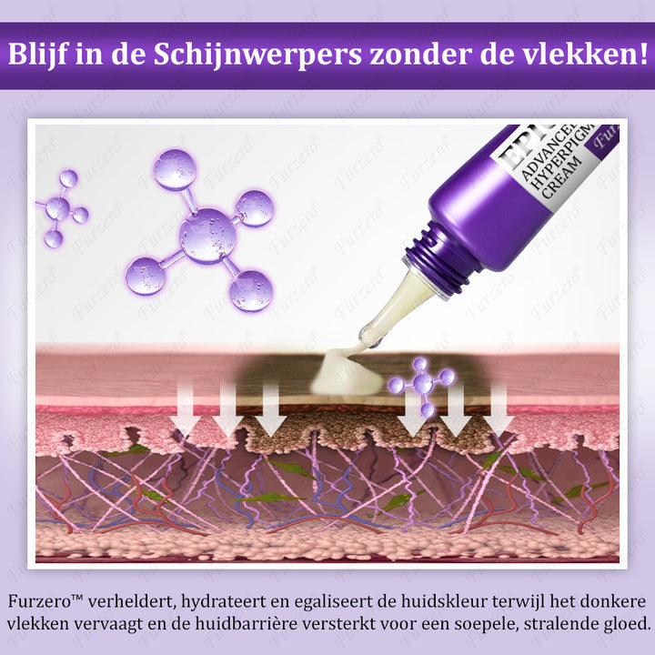 Glowvera™ Geavanceerde Anti- Hyperpigmentatie crème