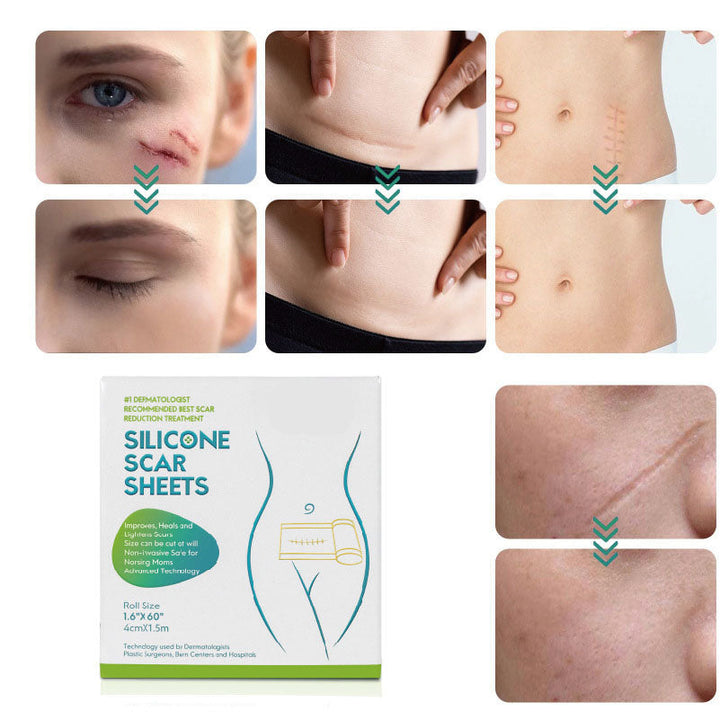 ScarCure™ Vermindert zichtbare littekens