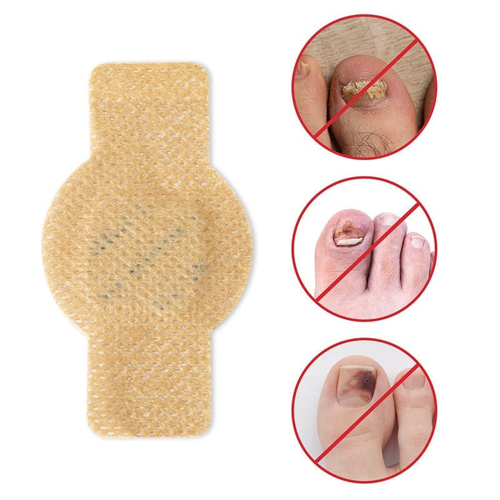 PureNail™ Herstel je Nagels Optimaal