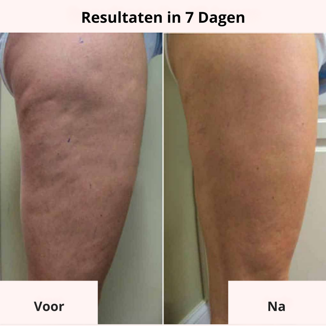Get Dreamy™ Een Zelfverzekerde Look