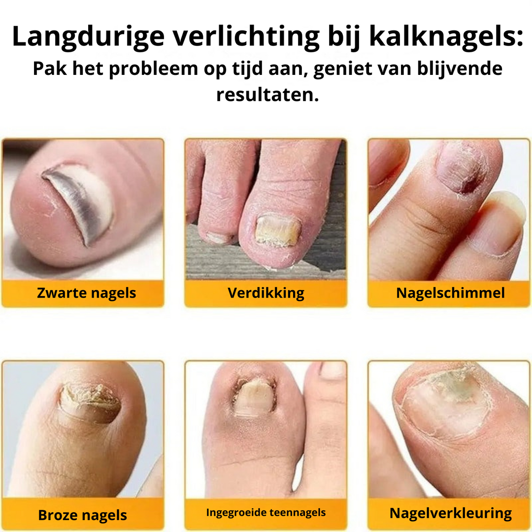 PureNail™ Herstel je Nagels Optimaal