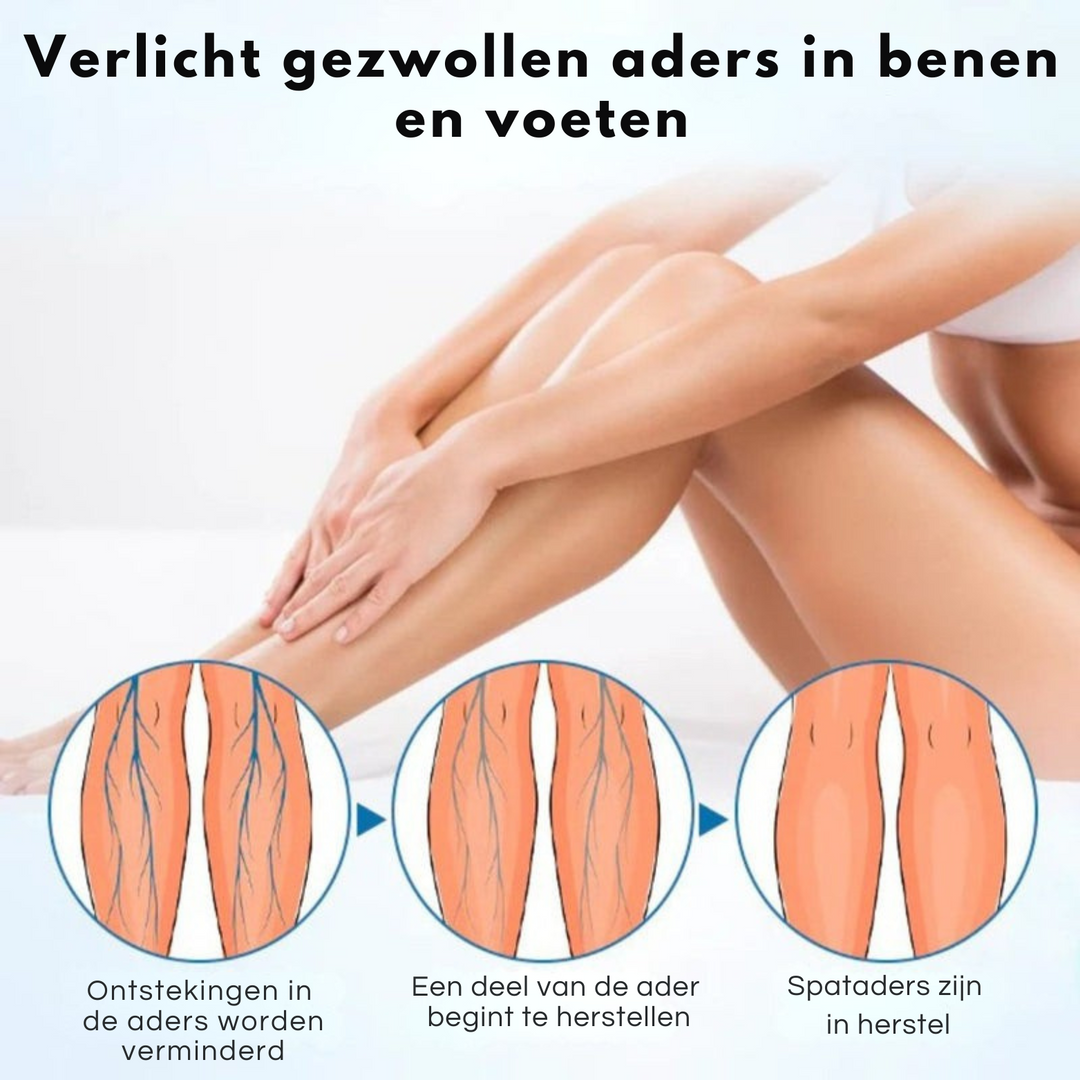 Timilk™ Vaarwel Tegen Spataders
