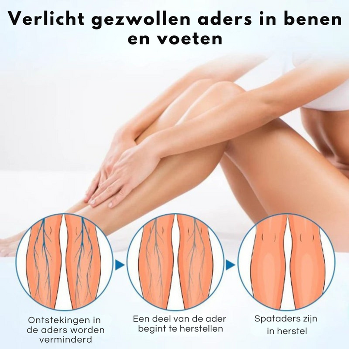 Timilk™ Vaarwel Tegen Spataders