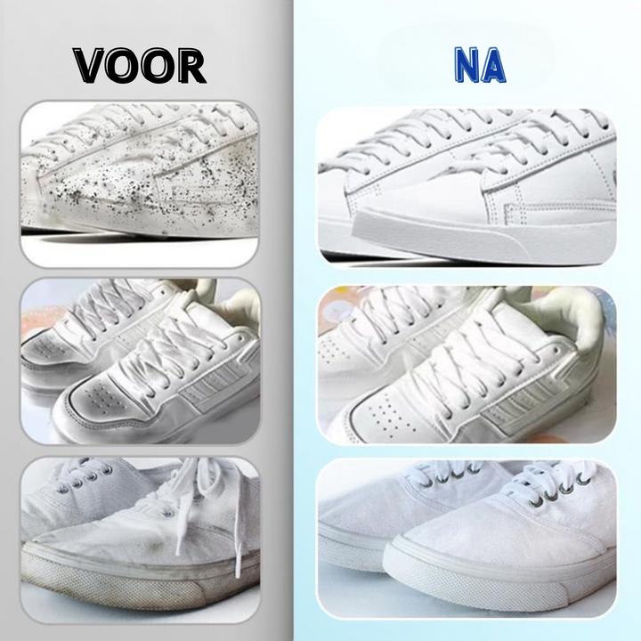 BrightKicks™ Laat je schoenen weer stralen