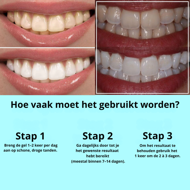 Dentiva™ Direct zichtbaar wittere tanden