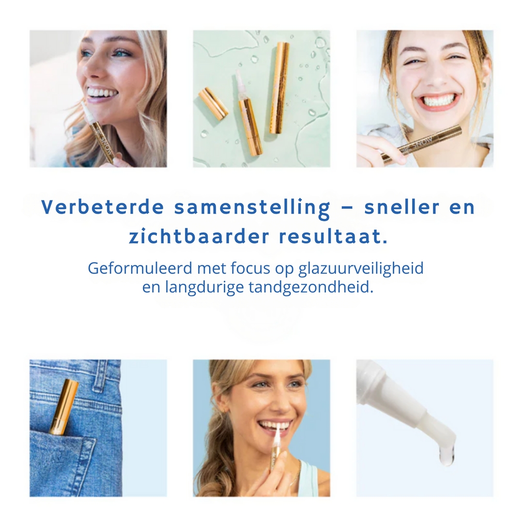 Dentiva™ Direct zichtbaar wittere tanden