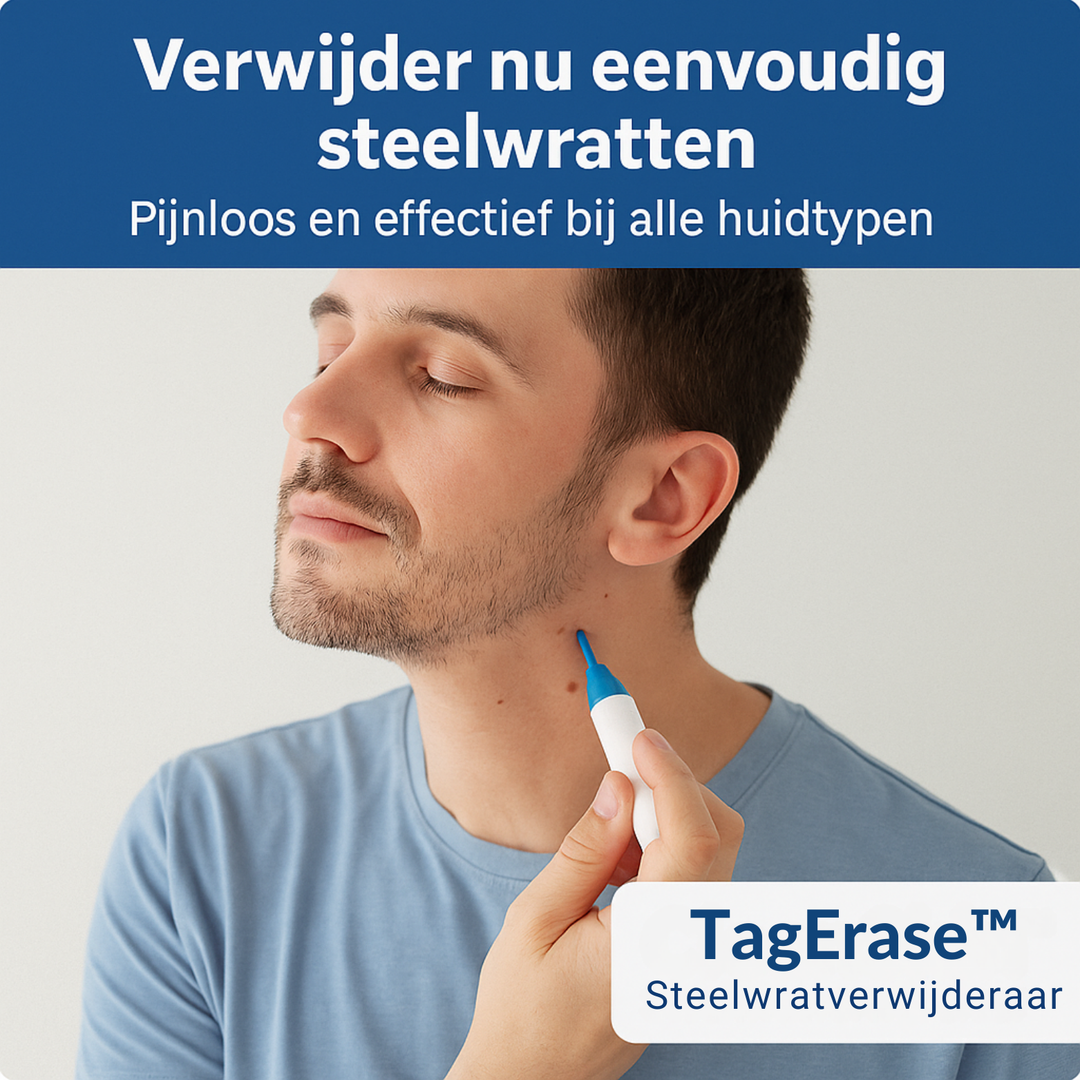 TagErase™ Een Pijnloos Vaarwel Tegen Steelwratten
