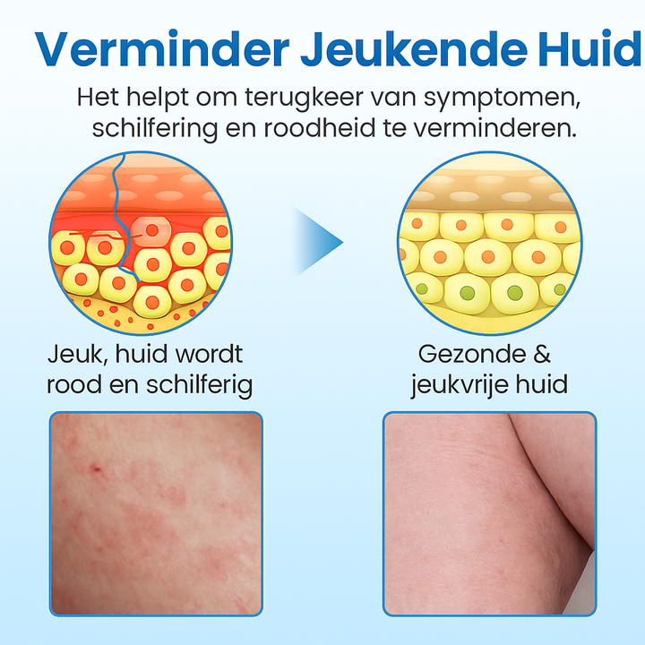 Calvex™ Vertrouwde Zalf voor Mannen