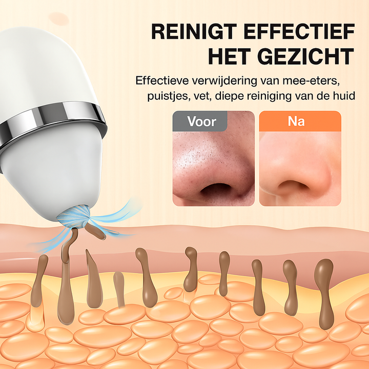 Veyra Derma Mee-Eters Verwijderaar
