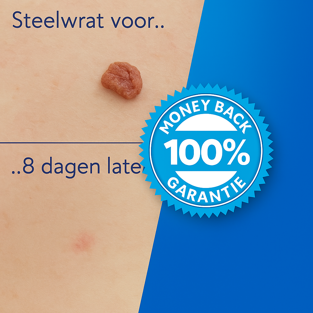 TagErase™ Een Pijnloos Vaarwel Tegen Steelwratten