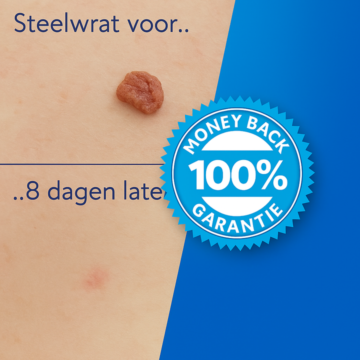 TagErase™ Een Pijnloos Vaarwel Tegen Steelwratten