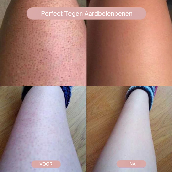 ShaveGlow™| 2-in-1 Dames Bodyshaver