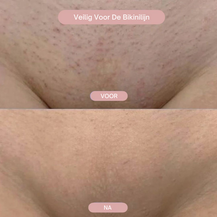 ShaveGlow™| 2-in-1 Dames Bodyshaver