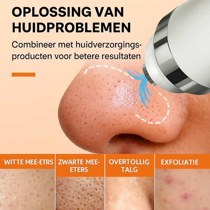 Veyra Derma Mee-Eters Verwijderaar
