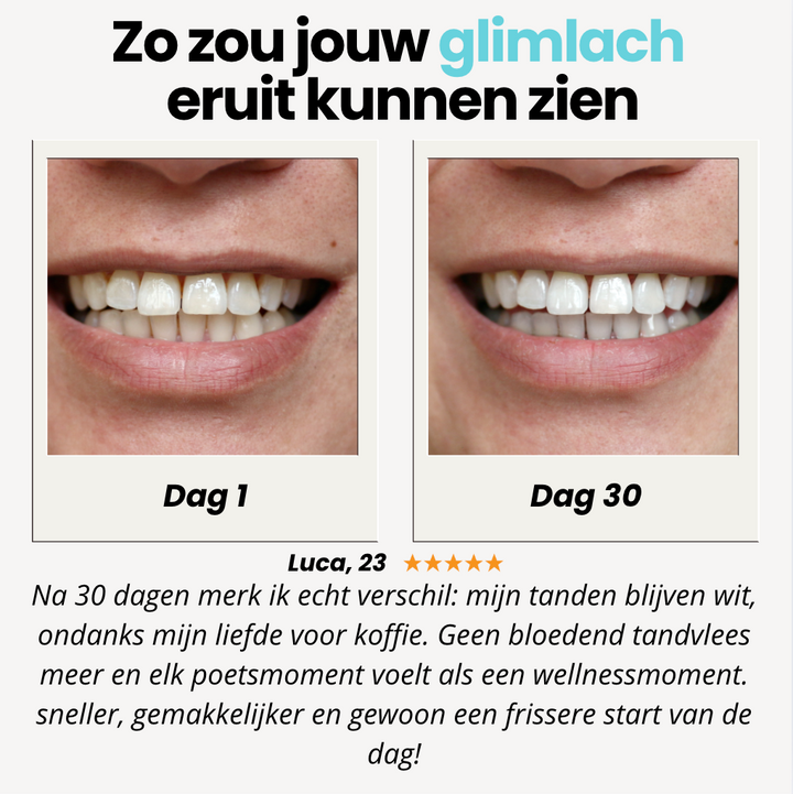 GlowBite™ Voor Een Stralende Glimlach