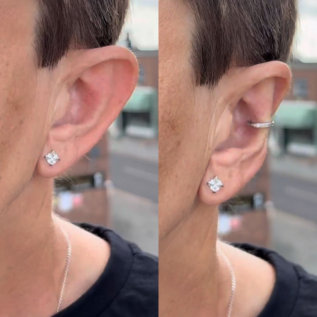Earvera™ Vaarwel Tegen Flaporen & Terug Zelfverzekerd