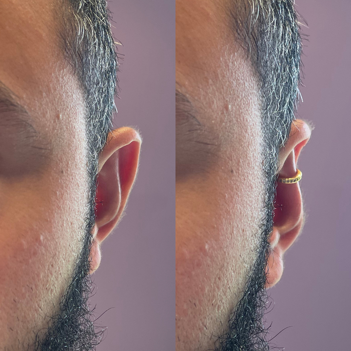 Earvera™ Vaarwel Tegen Flaporen & Terug Zelfverzekerd